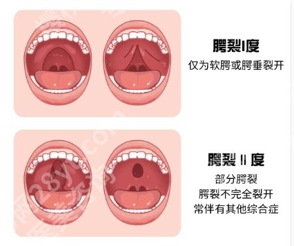 长春哪家医院做唇裂手术好？力荐医院名单一览！点击收藏