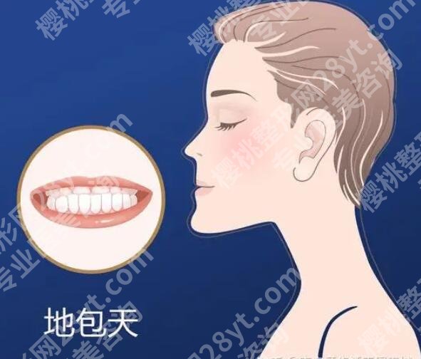 南京地包天哪家医院好？点击收藏这份人气榜单！