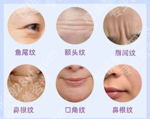 北京潞河医院整形美容价目表一览！项目细节公布！必看