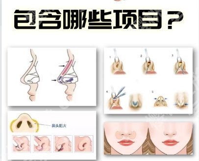 北京大学第一医院美容整形外科口碑如何？真人隆鼻案例鉴赏！
