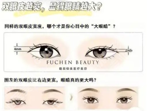 邝石峰医生做双眼皮怎么样？医生擅长项目简介！网友反馈