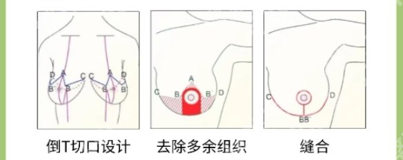唐志荣医生做隆胸价格更新！医生个人资料简介！价格参考