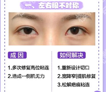 北京积水潭医院整形美容价目表一览！费用明细2025版公布！