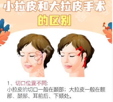 杜太超拉皮属于什么档次？口碑怎么样？医生技术、经验、价格曝光