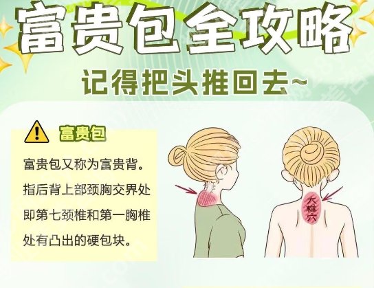 北京协和医院富贵包挂什么科？收费多少钱？科室资料-价格-案例鉴赏！