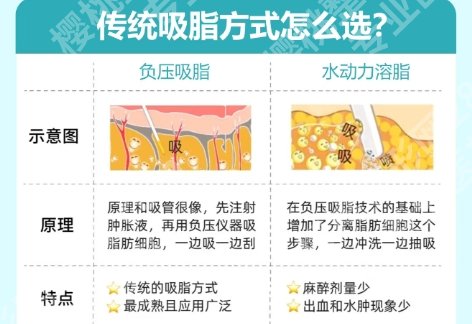 西京医院抽脂手术那个医生好点？医院价格明细表|人气医生介绍！