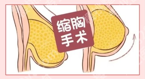 上海九院缩胸手术专家简介！医生名单揭秘|擅长项目详情！