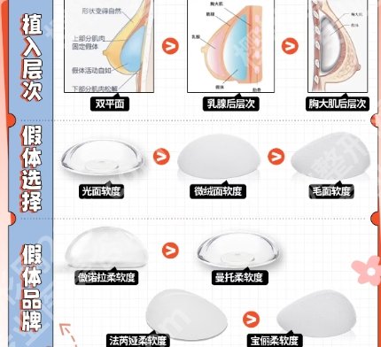北京协和医院隆胸咋样啊？技术靠谱吗？网友真实点评附上！