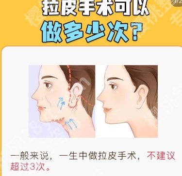 西京医院拉皮手术价格贵不贵？医院简介|经典案例展示！