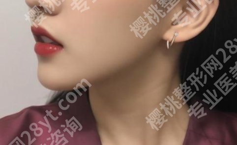 北京八大处磨骨手术价目表揭晓！戳进来看热心网友点评吧！