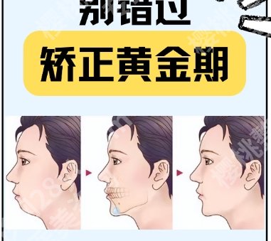 上海中山医院正颔手术多少钱？收费标准更新！戳进来俺