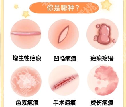 北京八大处和南京皮研所疤痕疙瘩哪个好？医院口碑点评！