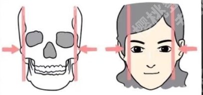 北京八大处颧骨内推多少钱？医院详细介绍！口碑点评