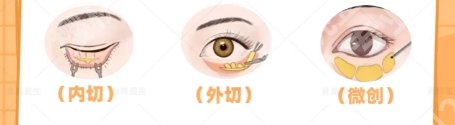 深圳北大医院祛眼袋专家！院内实力医生简介！就诊必看