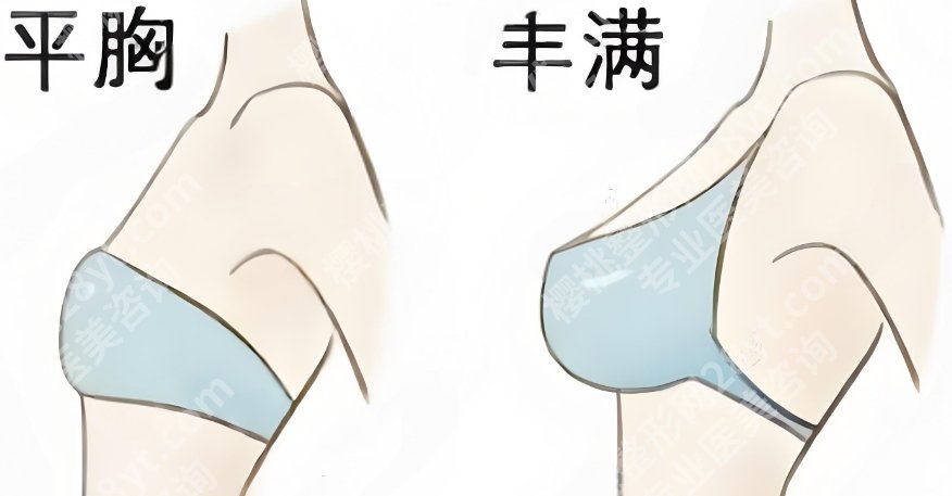 北医三院隆胸怎么样？医院详细介绍！顾客点评