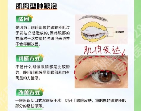 上海时光做双眼皮怎么样？医院环境舒适优雅|口碑反馈较好！