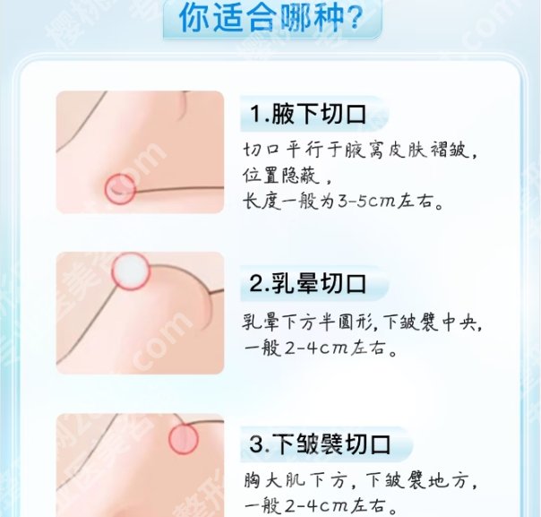 彭栋梁医生隆胸怎么样了？医生明星项目介绍！口碑超好