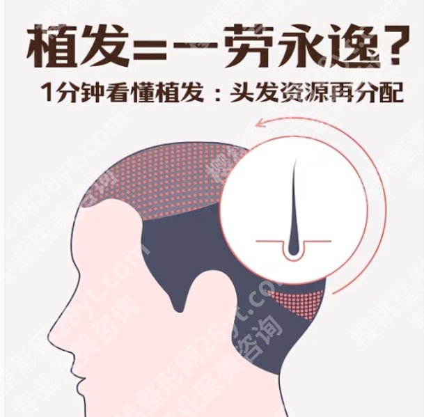 西安植发哪家好？top榜前五排名和价格曝光！(2025下)
