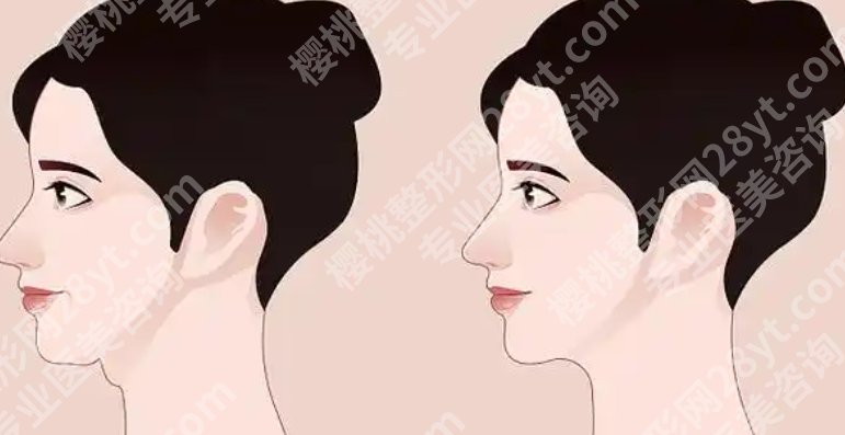 黄大勇颧骨颧弓两件套多少钱？医生擅长项目简介！