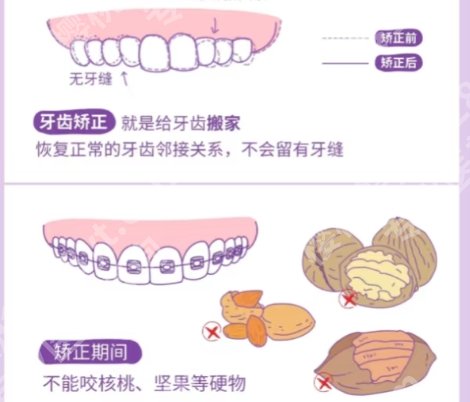 天津牙齿矫正价格多少钱？贵不贵？收费标准更新！
