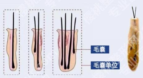 长沙植发医院有哪些？医院技术水平特色！好评如潮