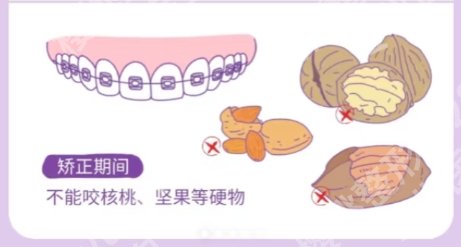 北京地包天矫正医院排名公布！推荐几家口碑不错的医院！