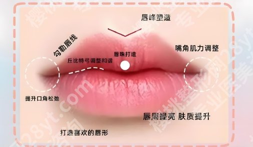 上海玻尿酸丰唇需要多少钱？医院价格表单新鲜出炉！