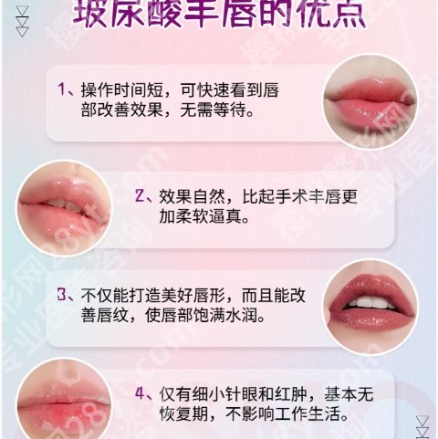 上海玻尿酸丰唇需要多少钱？医院价格表单新鲜出炉！