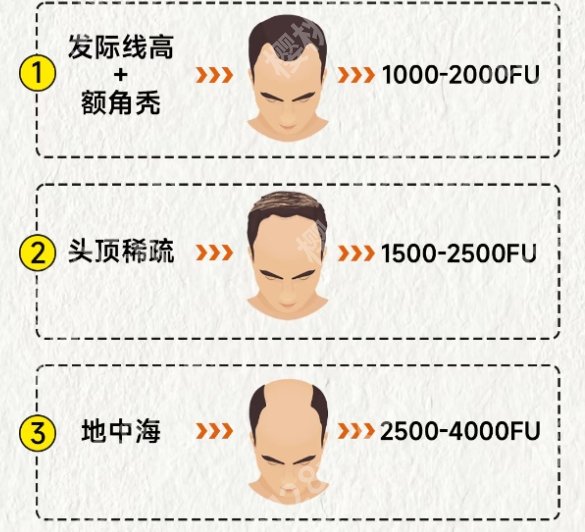 淮安植发哪家好？2025年医院排行榜全新出炉！