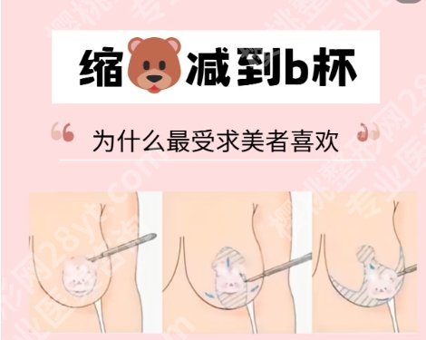 上海时光做缩胸手术多少钱？全新收费标准一览！