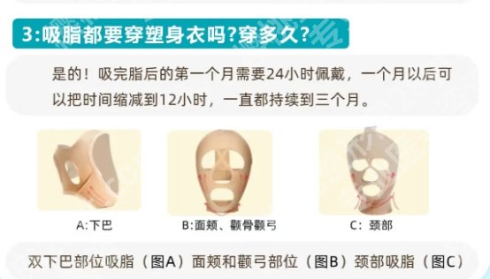 广医附一院吸脂价格！医院背景相关介绍！点击收藏！