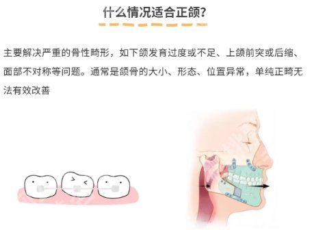 北京深覆合正颌手术要多少钱？医院价目表参考！速速码住