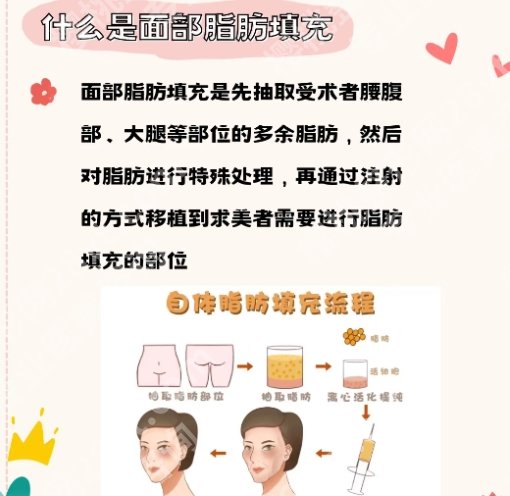 广医三院脂肪填充术多少钱?院内特色项目简介!