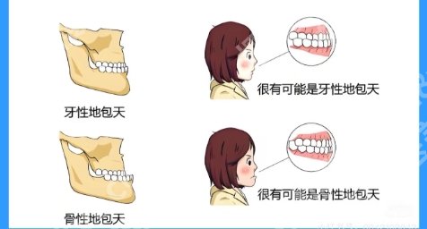 南昌地包天正颌手术医生有哪些?医生技术好经验丰富!