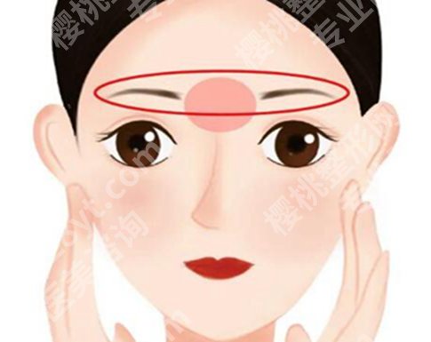 黄莹滢双眼皮怎么样？一键查看医生信息
