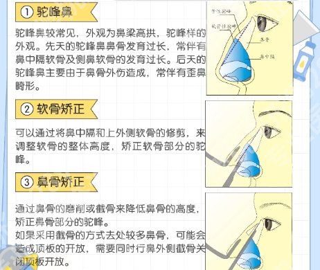 邸红亮医生口碑怎么样?医生技术精湛|擅长项目种类!