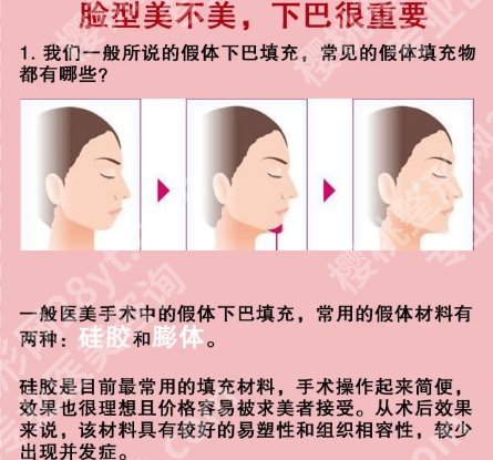 上海九院垫下巴要多少钱？医院技术和实力都不容小觑!