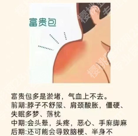 上海九院做富贵包好吗？医院具体相关信息！附案例分享