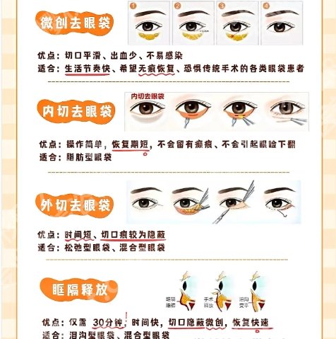 北医三院去眼袋专家介绍！分享了医院详细资料！一键收藏