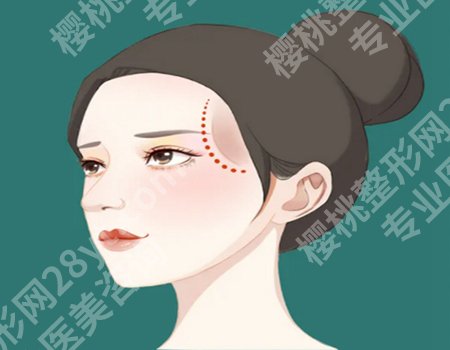乔雅登是几号玻尿酸？找审美和技术在线的医生