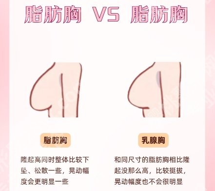 南方医院隆胸医生技术实力不容小觑！附案例分享！