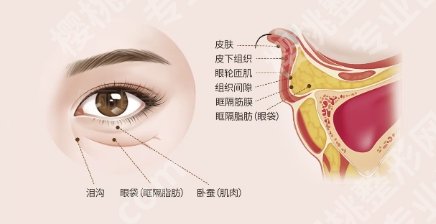 北医三院祛眼袋好吗？医院技术提升！口碑点评