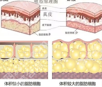 泰兴人民医院整形美容价目表一览！项目明细介绍！戳进来看