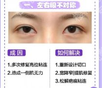 泰州人民医院整形美容价目表一览！热门项目介绍！