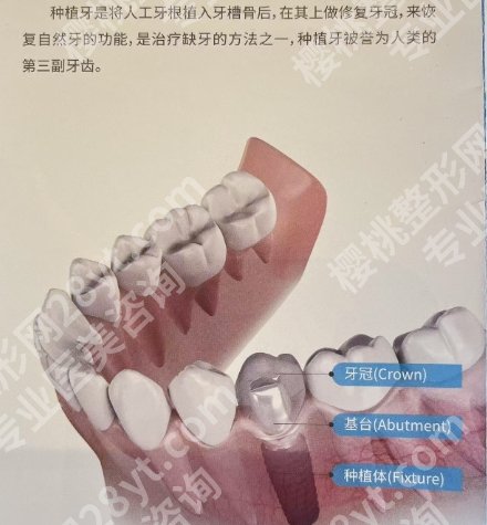 淮安种植牙医院排行名单来了!来看看有没有你心仪的医院!