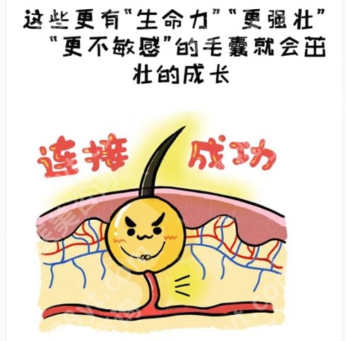 遵义植发哪家医院好？医院技术好声誉高名！价格透明