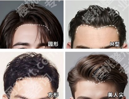潍坊植发哪个医院好?医院实力强技术特色优势!