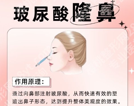 上海九院鼻子整形需要多少钱？医生名单揭秘！客户口碑