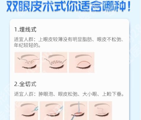 株洲割双眼皮好的医院是哪家?排行榜10强名单曝光!详细简介