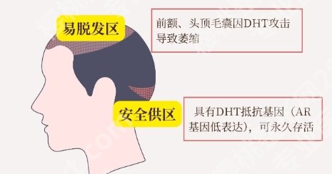 揭阳植发医院哪家医技术好？医院详情介绍！点击查询